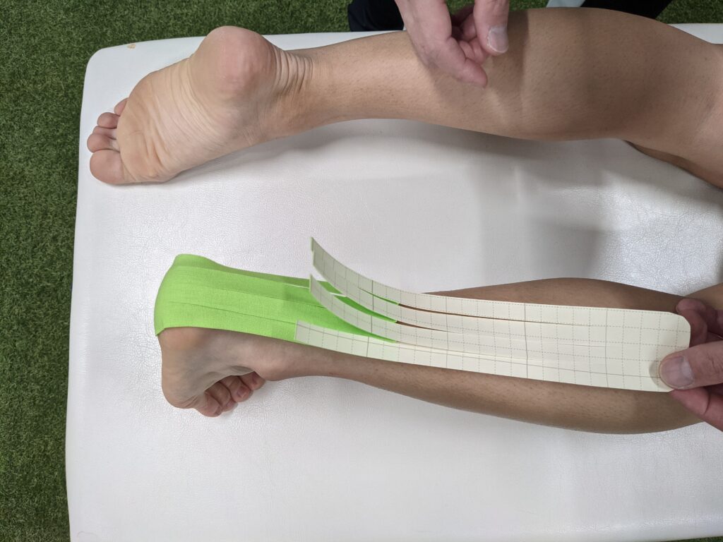 アキレス腱の張り 痛みに対するテーピング Pleady