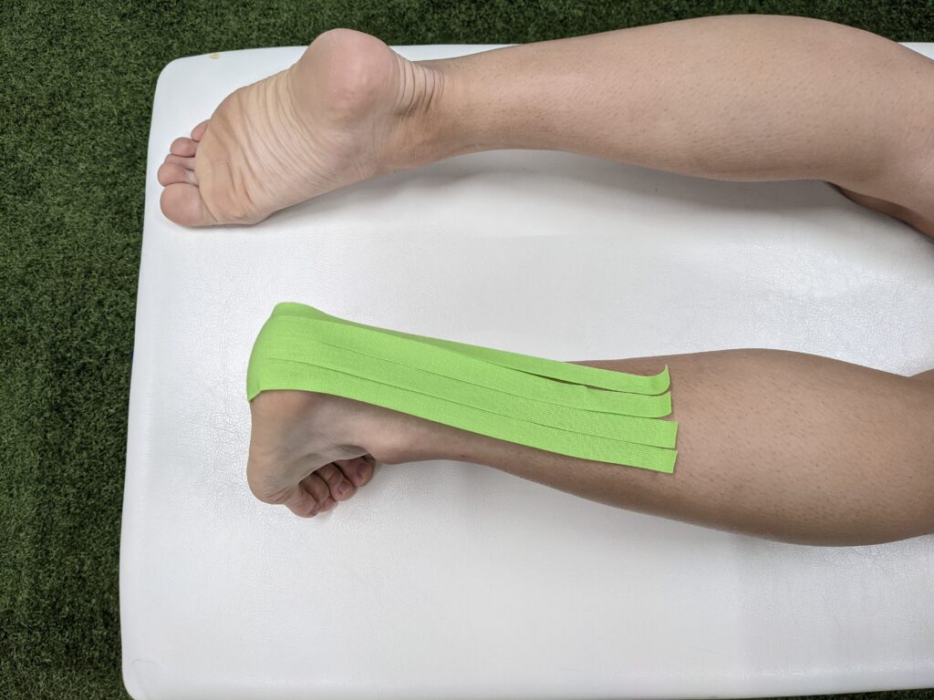 アキレス腱の張り 痛みに対するテーピング Pleady アキレス腱の張り 痛みに対するテーピング Pleady
