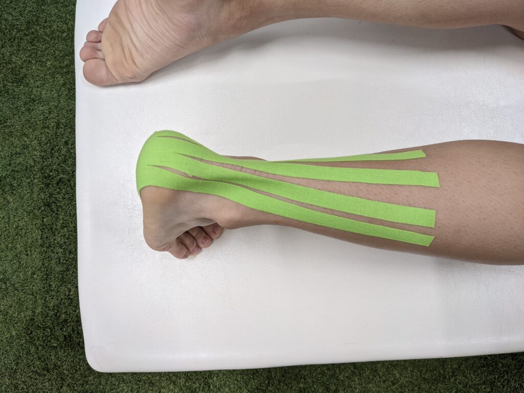 アキレス腱の張り 痛みに対するテーピング Pleady アキレス腱の張り 痛みに対するテーピング Pleady