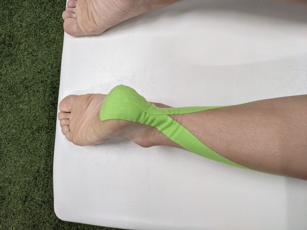 ふくらはぎのつり むくみ 疲労に対するテーピング Pleady