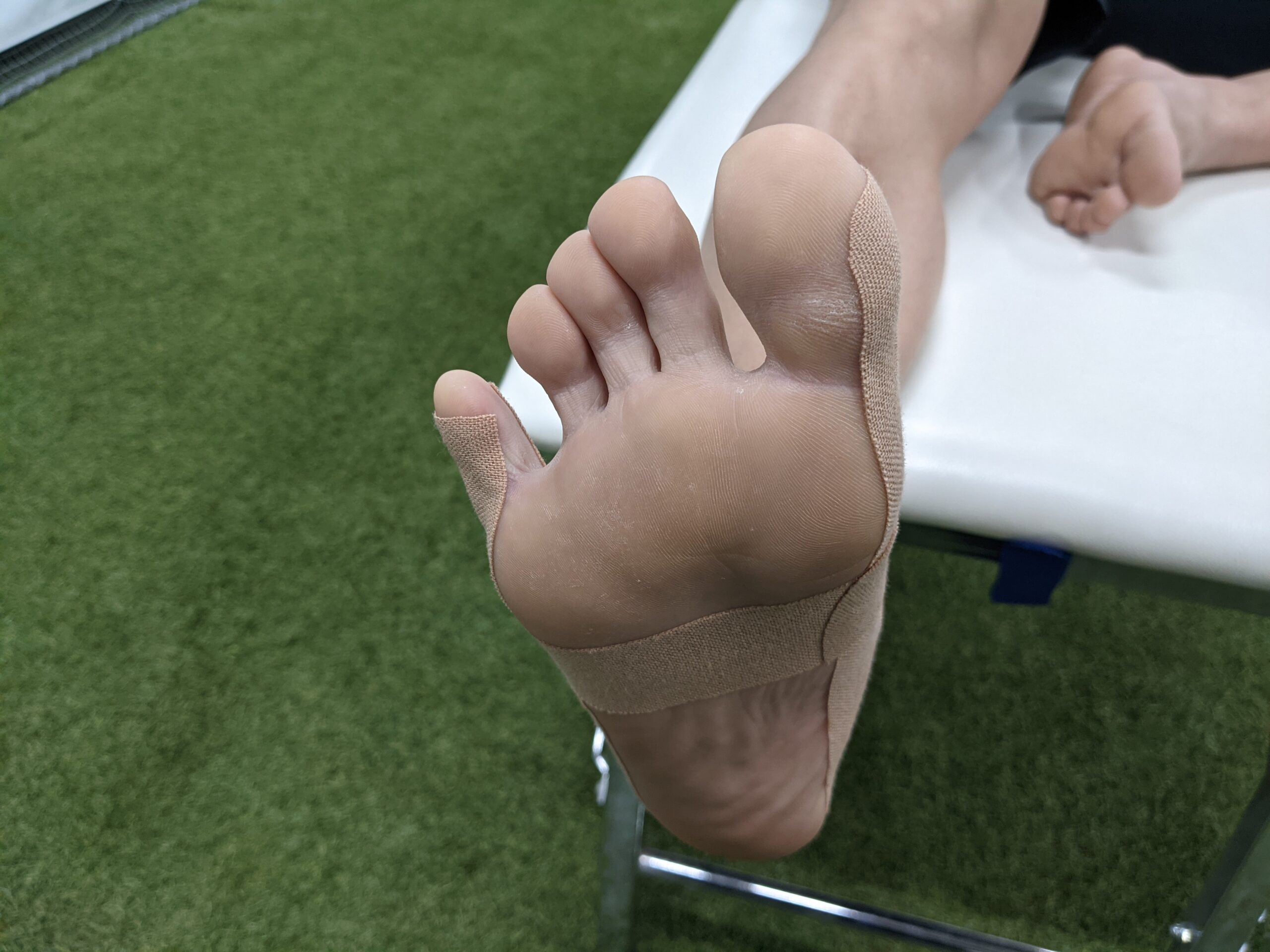 足の指の付け根の違和感 痛みに対する外反母趾のテーピング Pleady
