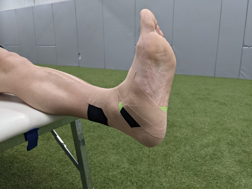 足首のねんざに対するテーピング Pleady 足首のねんざに対するテーピング Pleady